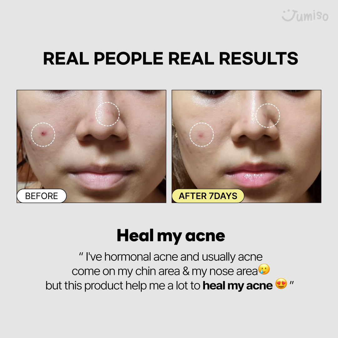 Snail Mucin 95% + Peptide Essence 50ml