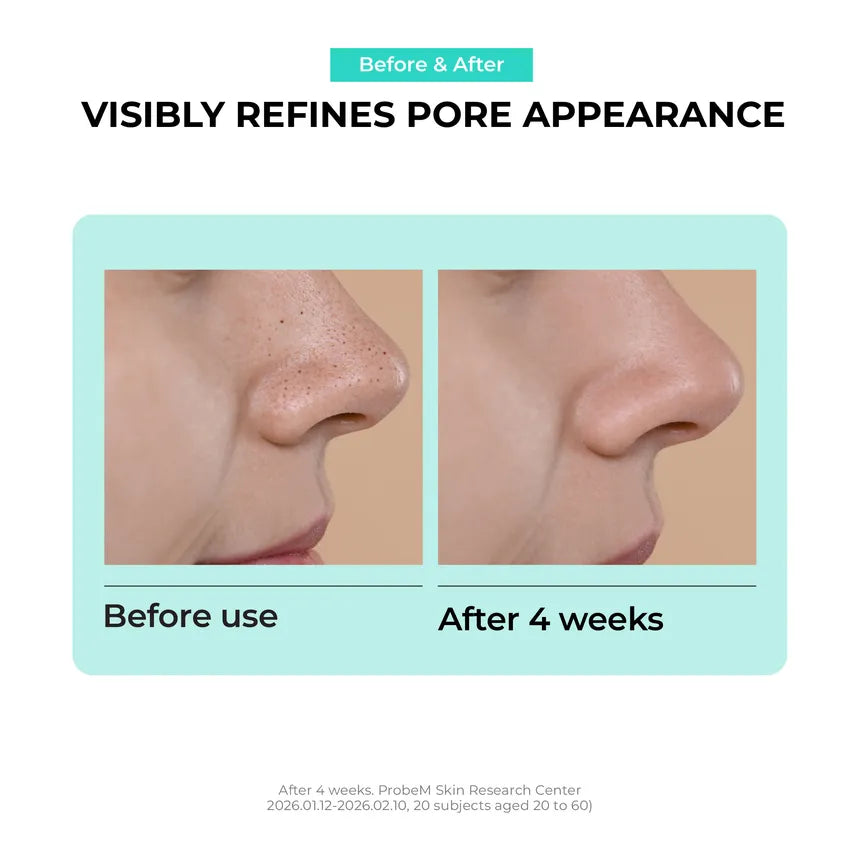 Overnight Zero Pore Nose Patch 10 patches