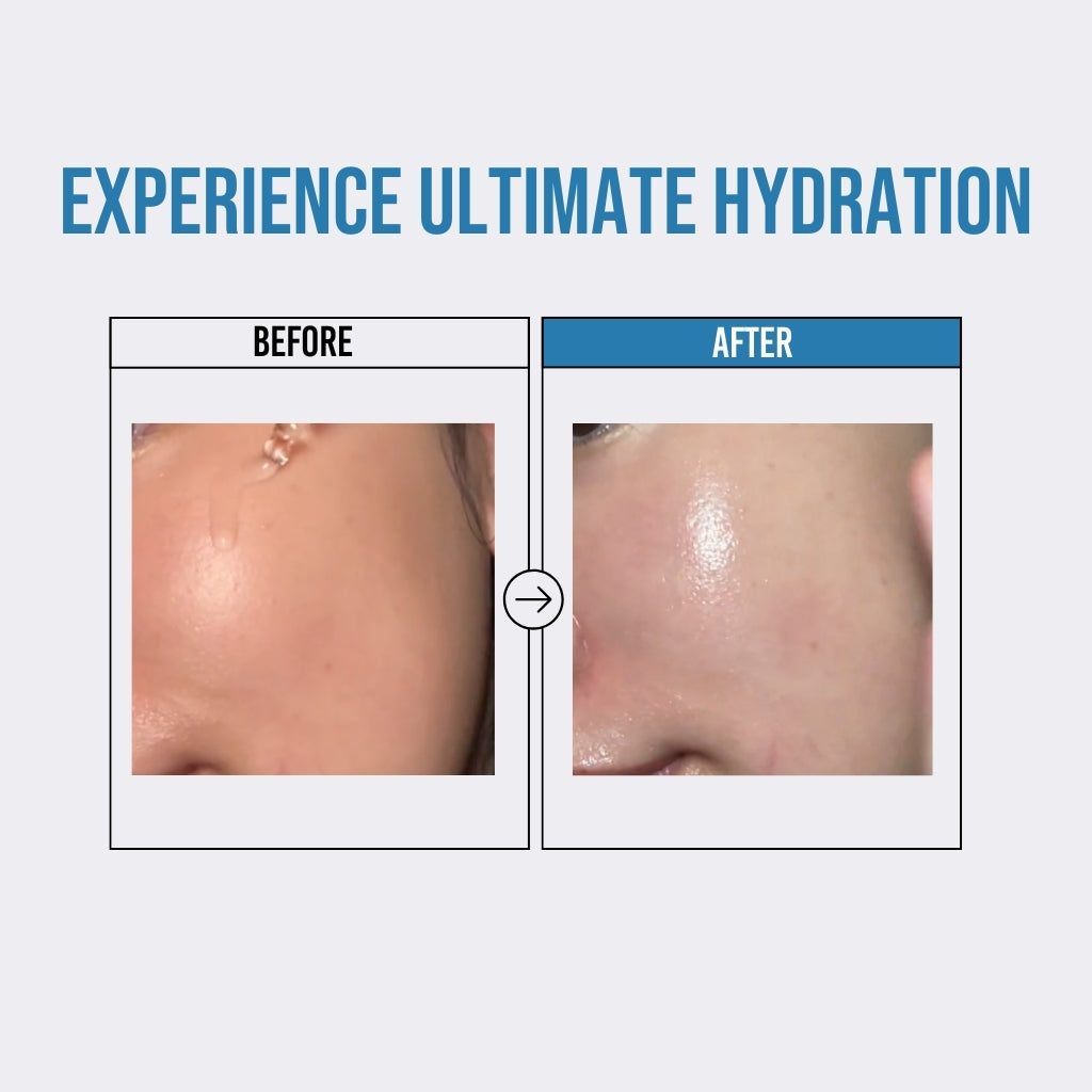 Waterfull Hyaluronic Acid Serum 50ml