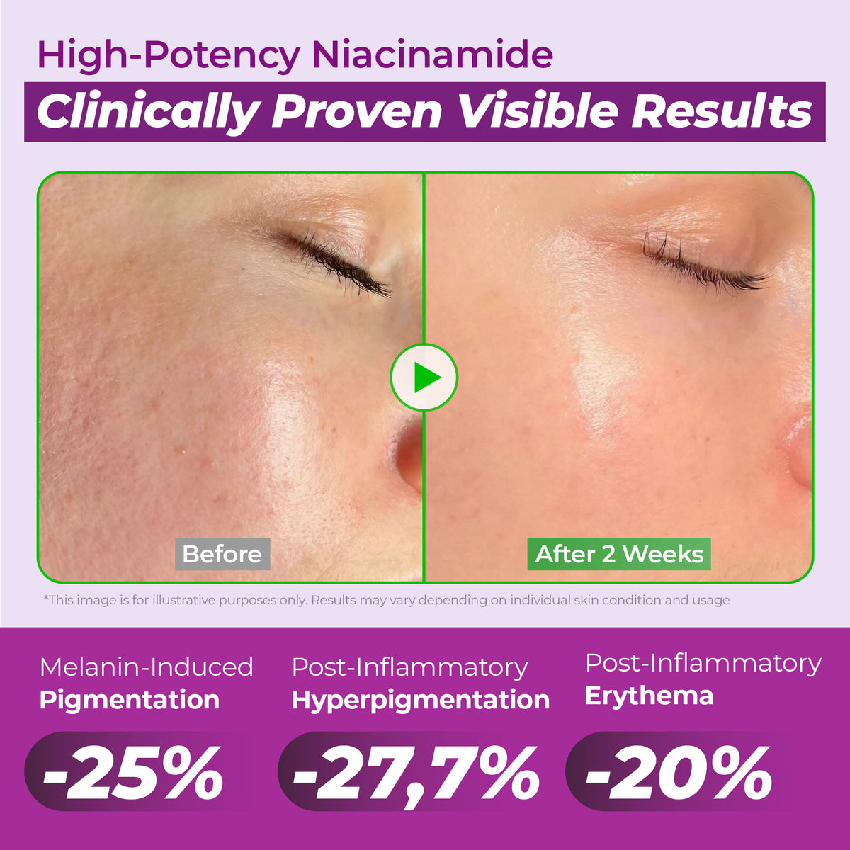 20% NIACINAMIDE High Potency Dark Spot Serum Duo