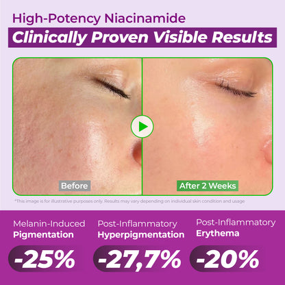 20% NIACINAMIDE High Potency Dark Spot Serum Duo