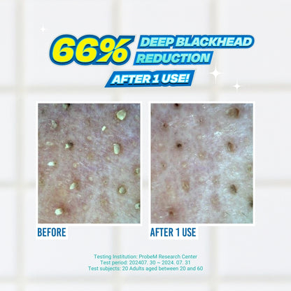 [NEW] Blackhead Melting Softner 150ml