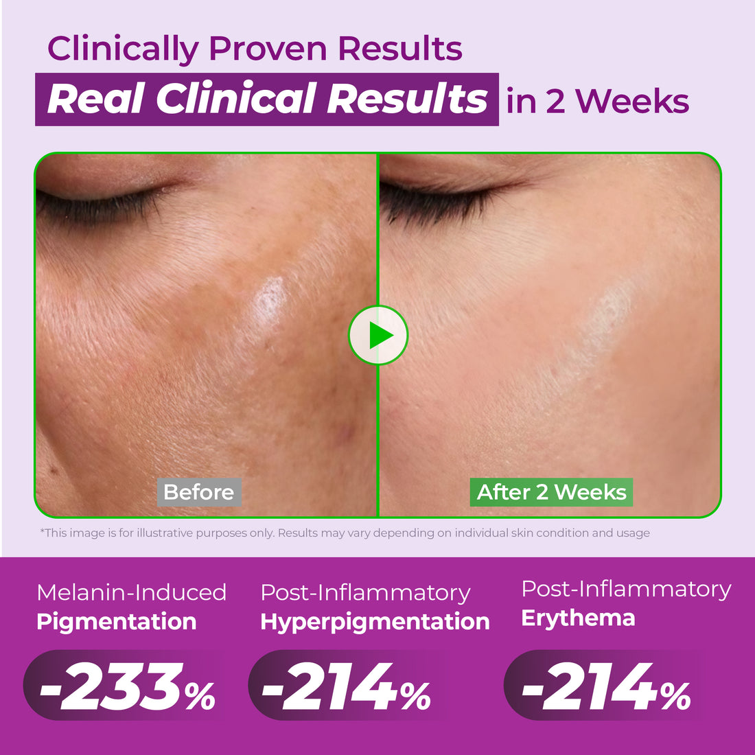 20% NIACINAMIDE High Potency Dark Spot Serum (Copy_c)