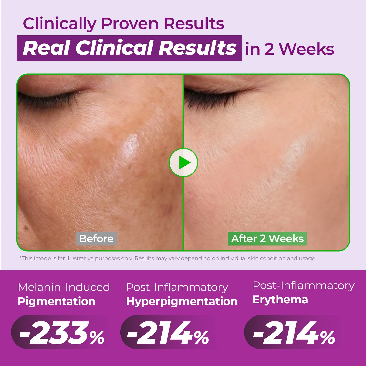 20% NIACINAMIDE High Potency Dark Spot Serum (Copy_s13)