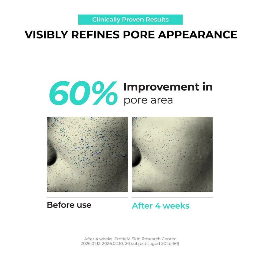 Overnight Zero Pore Nose Patch 10 patches