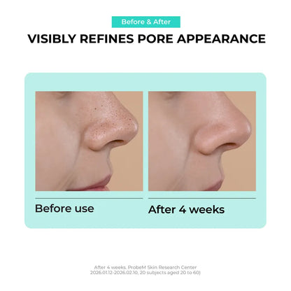 Overnight Zero Pore Nose Patch 10 patches