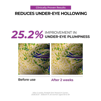 [NEW] Niacinamide 5+ Dark Circle Correcting Eye Cream 15ml