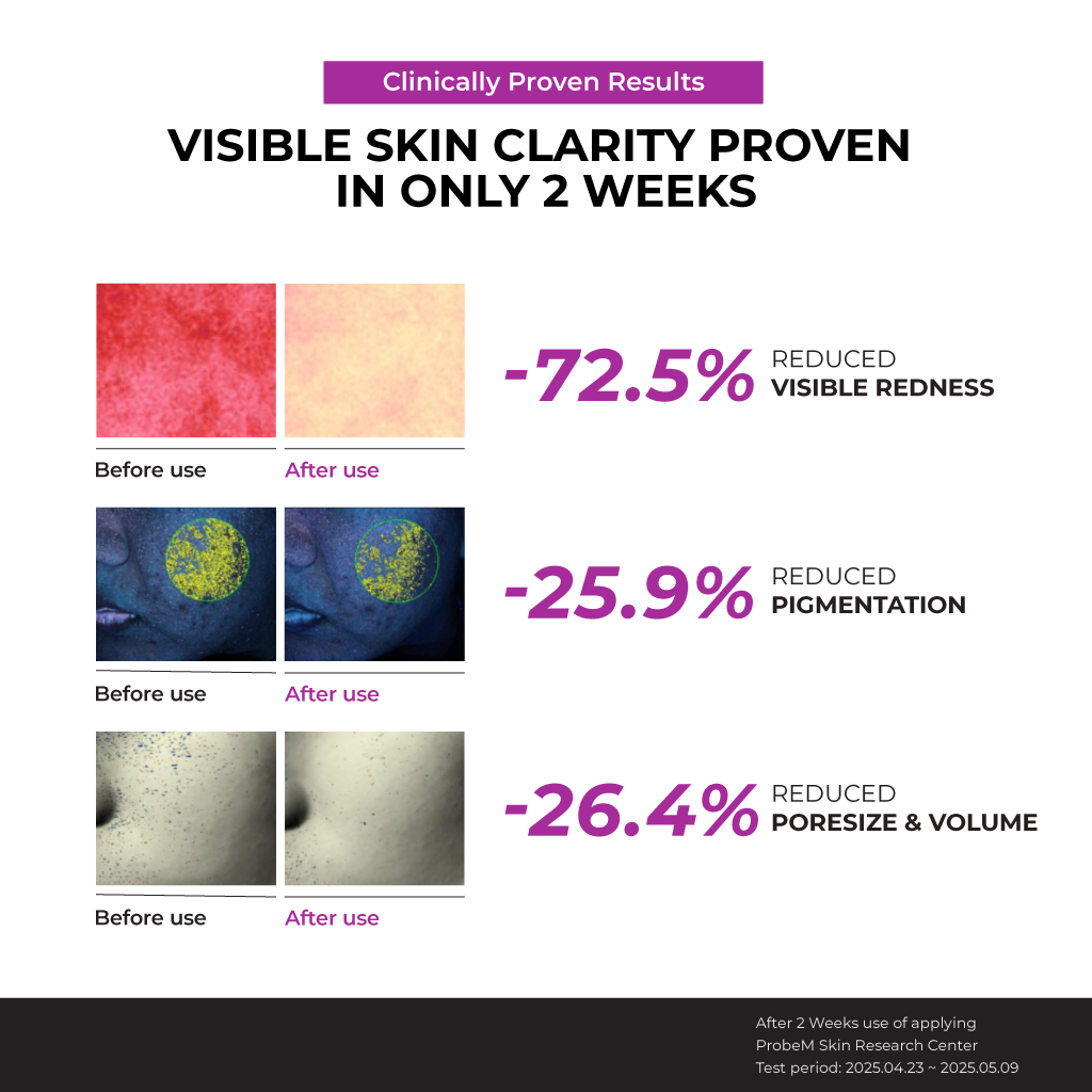 [NEW] Niacinamide 10% Serum