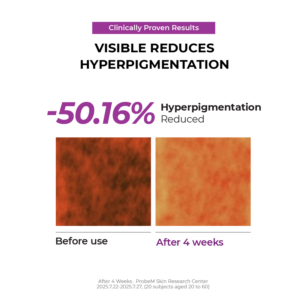 [NEW] Niacinamide 5+ Overnight Cream 50ml