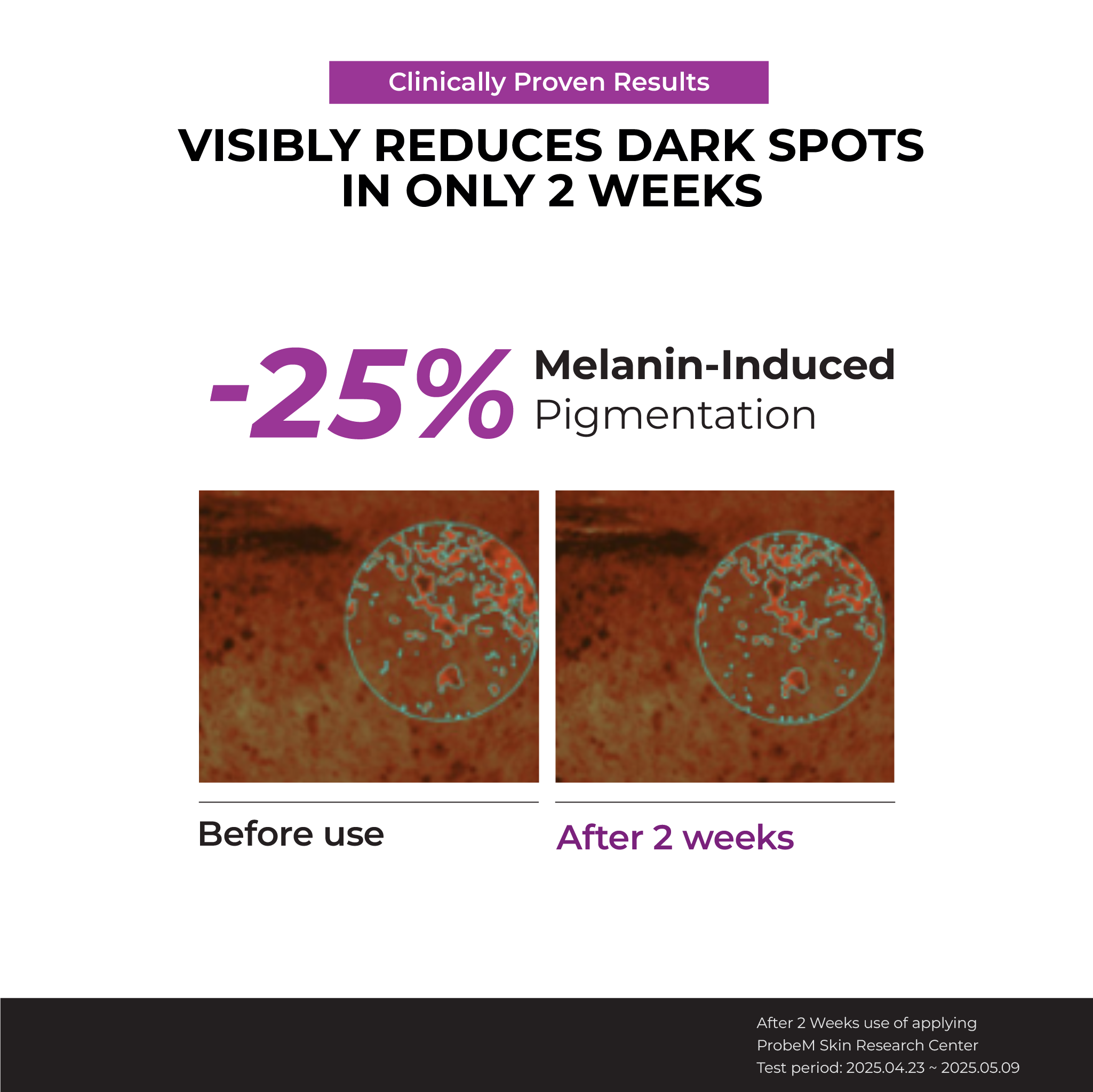 [NEW] Niacinamide 20% Serum