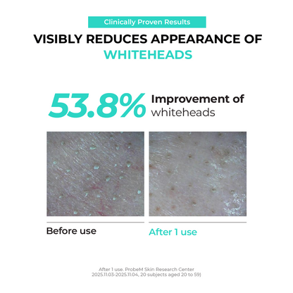 Pore Melting Peeling Gel 150ml