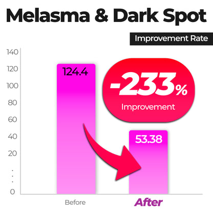 20% NIACINAMIDE High Potency Dark Spot Serum (Copy_s13)