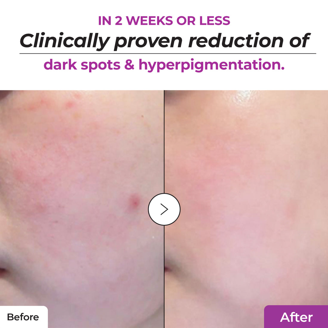 Niacinamide 20% Serum